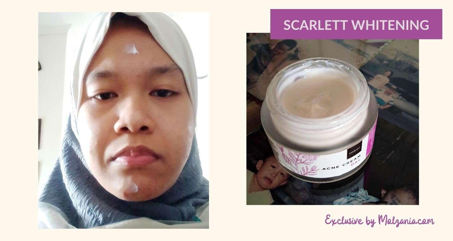 Review Scarlett Whitening Day & Night Acne Cream