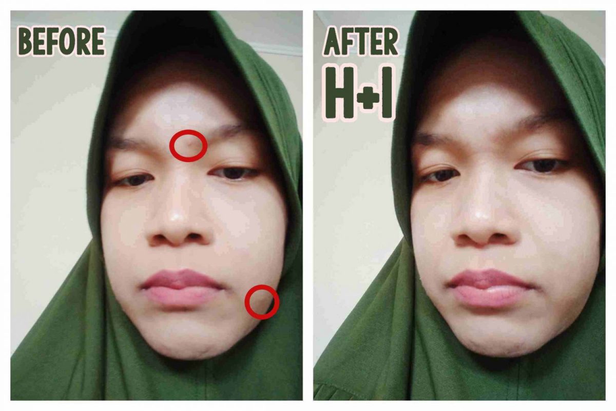 Before - After Pemakaian Produk