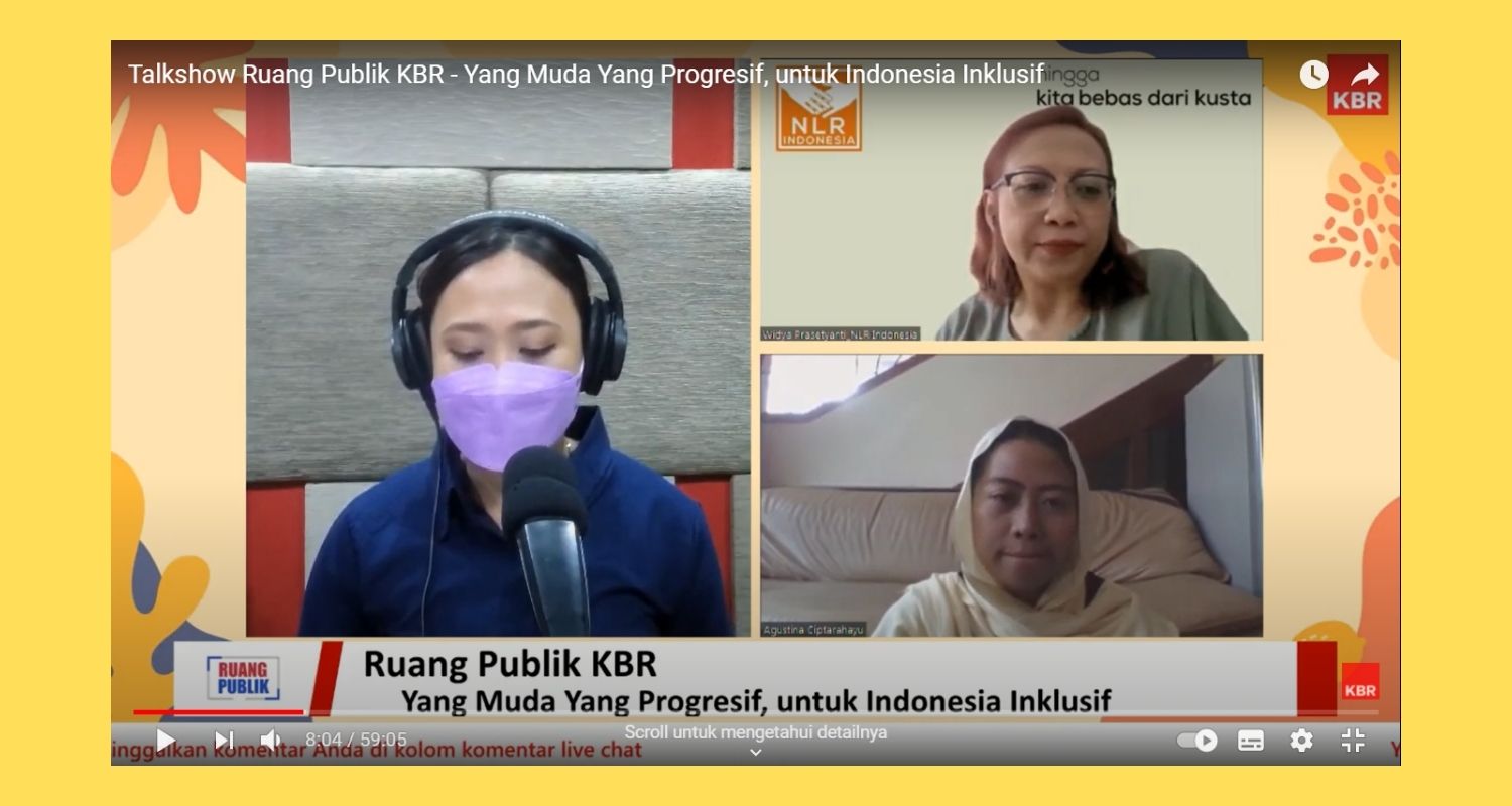Tips Menjadi Perusahaan Inklusif yang Ramah Disabilitas