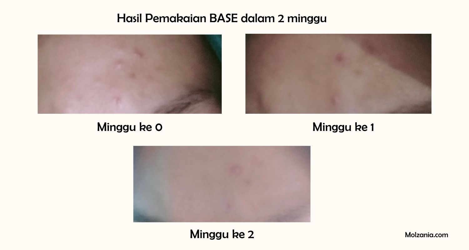 Hasil Pemakaian Skincare BASE dalam 2 minggu